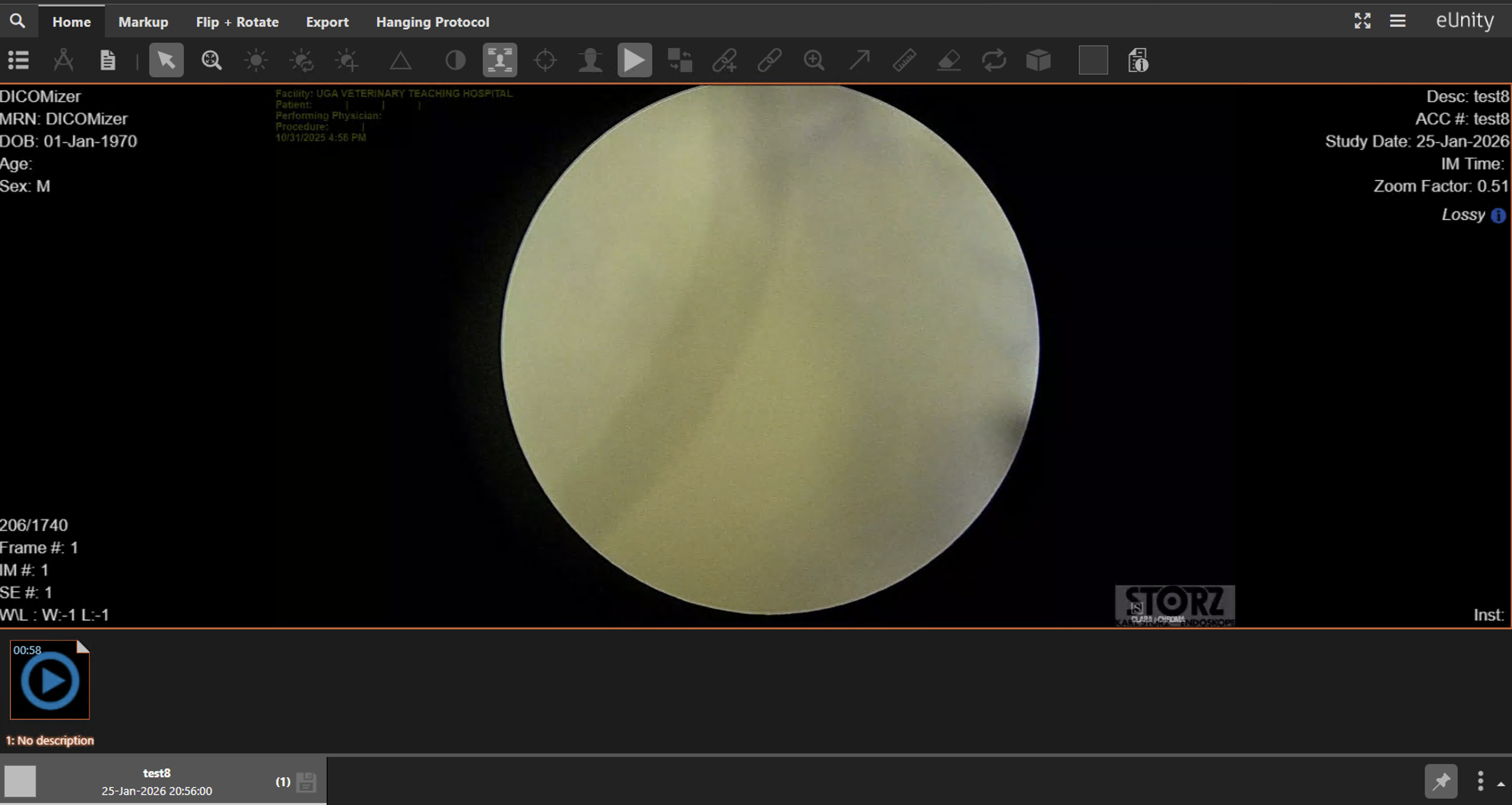 Result in eUnity PACS viewer